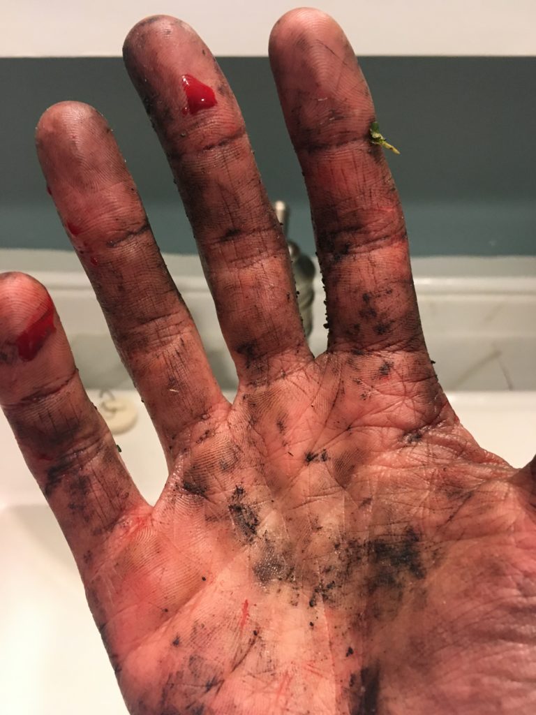 Bloody dirty hands